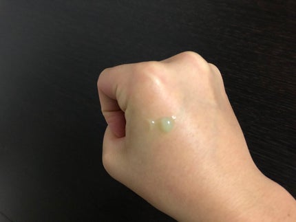 オロナインH軟膏 (医薬品)/オロナイン/その他を使ったクチコミ(3枚目)