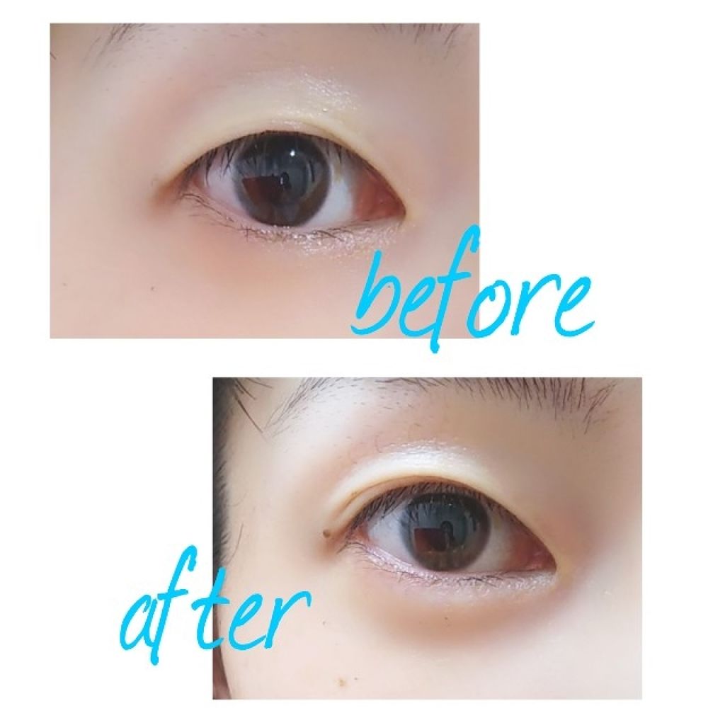 リッドキララ/北の快適工房/アイケア・アイクリームを使ったクチコミ(4枚目)