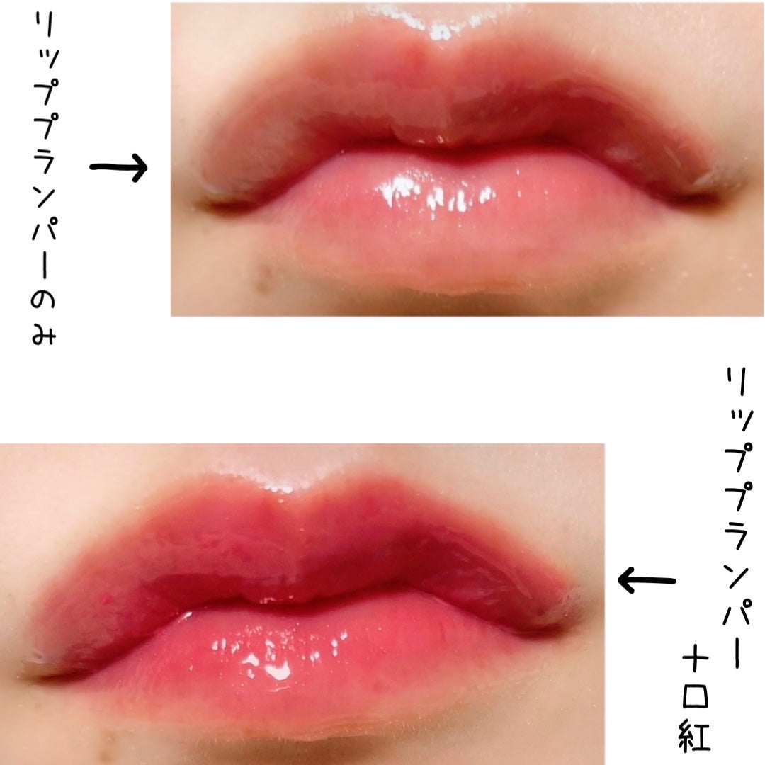 キューミ―ボムショットリッププランパー/AGARISM/リッププランパーを使ったクチコミ(5枚目)