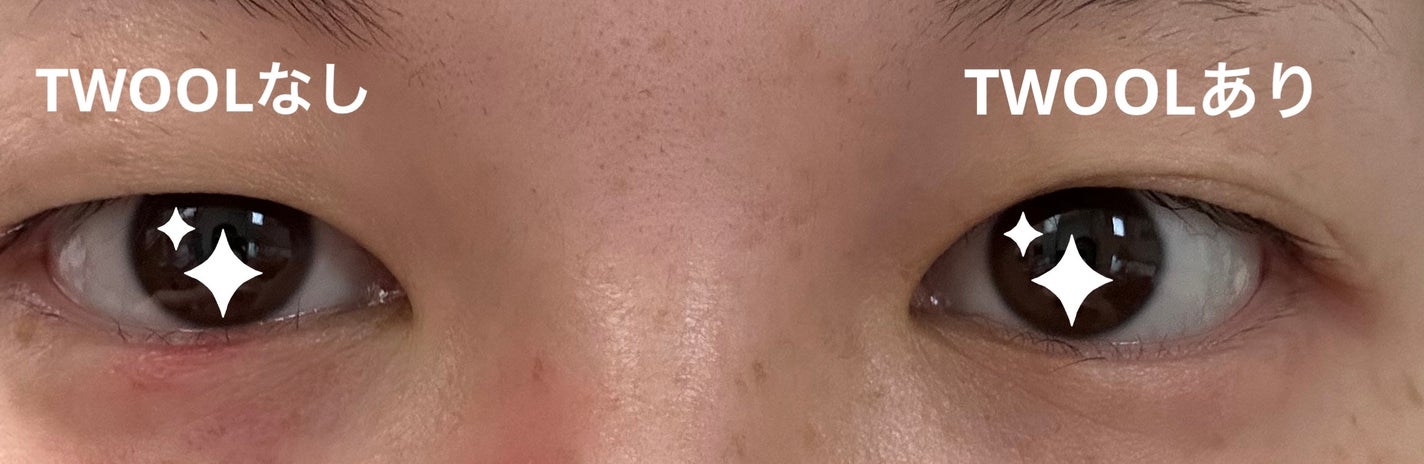 TWOOL ダブルアイリッドグルー/SHOBIDO/二重まぶた用アイテムを使ったクチコミ(4枚目)
