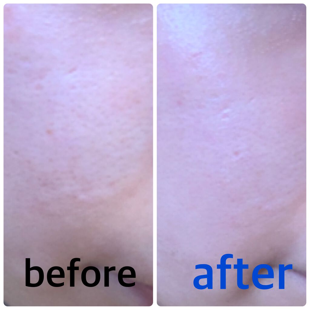 UVイデア XL プロテクショントーンアップ/ラ ロッシュ ポゼ/日焼け止めクリームを使ったクチコミ(3枚目)