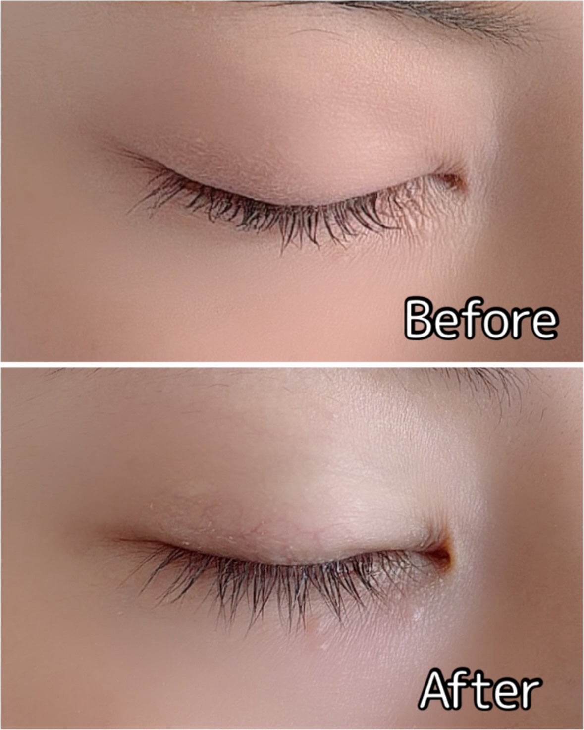 リアルミービオテノールラッシュアップアンプル/ベリサム/まつげ美容液を使ったクチコミ(3枚目)