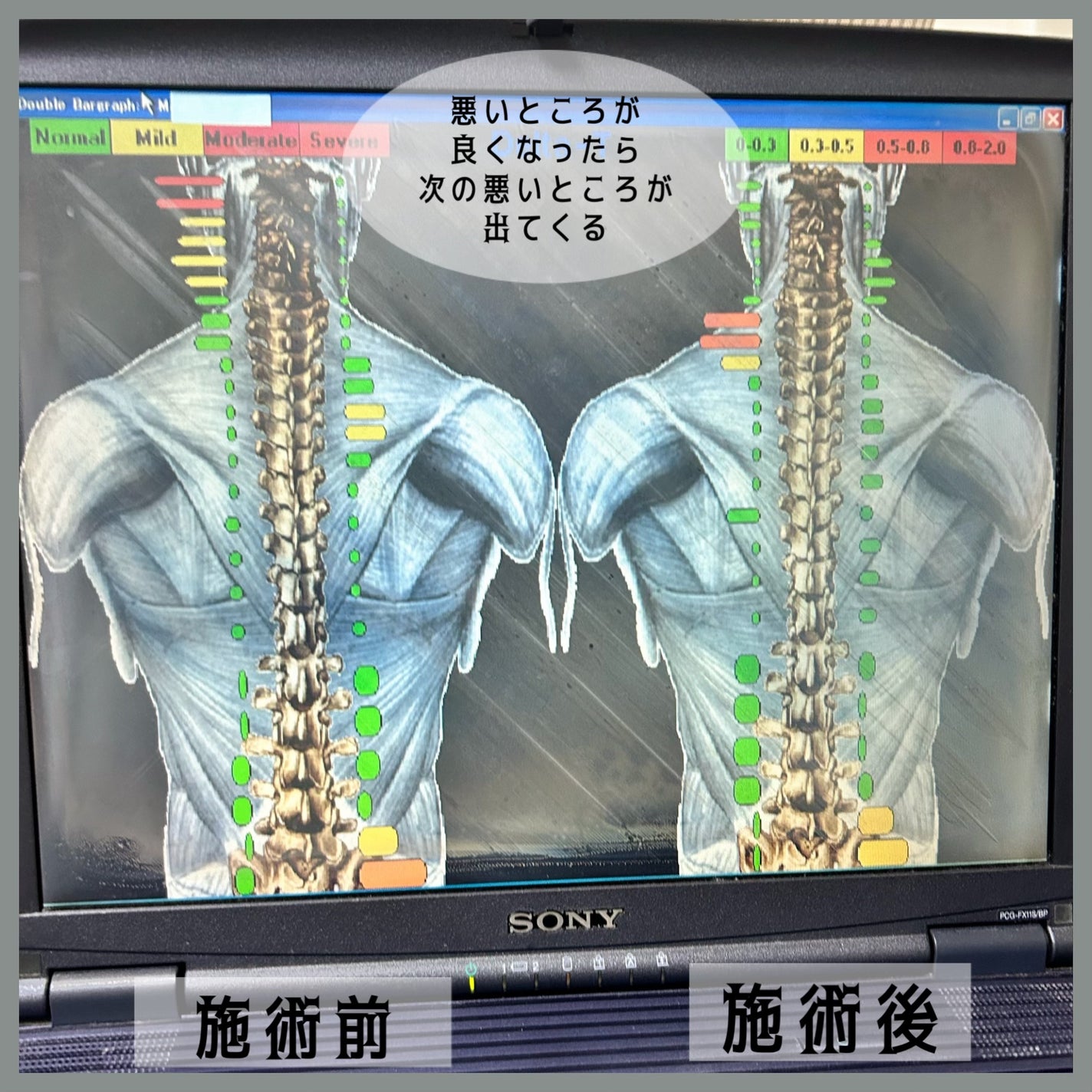 エミリー@フォロバ100 on LIPS 「・・ライズ カイロプラクティック二子新地駅から徒歩2分のカイロ..」(6枚目)