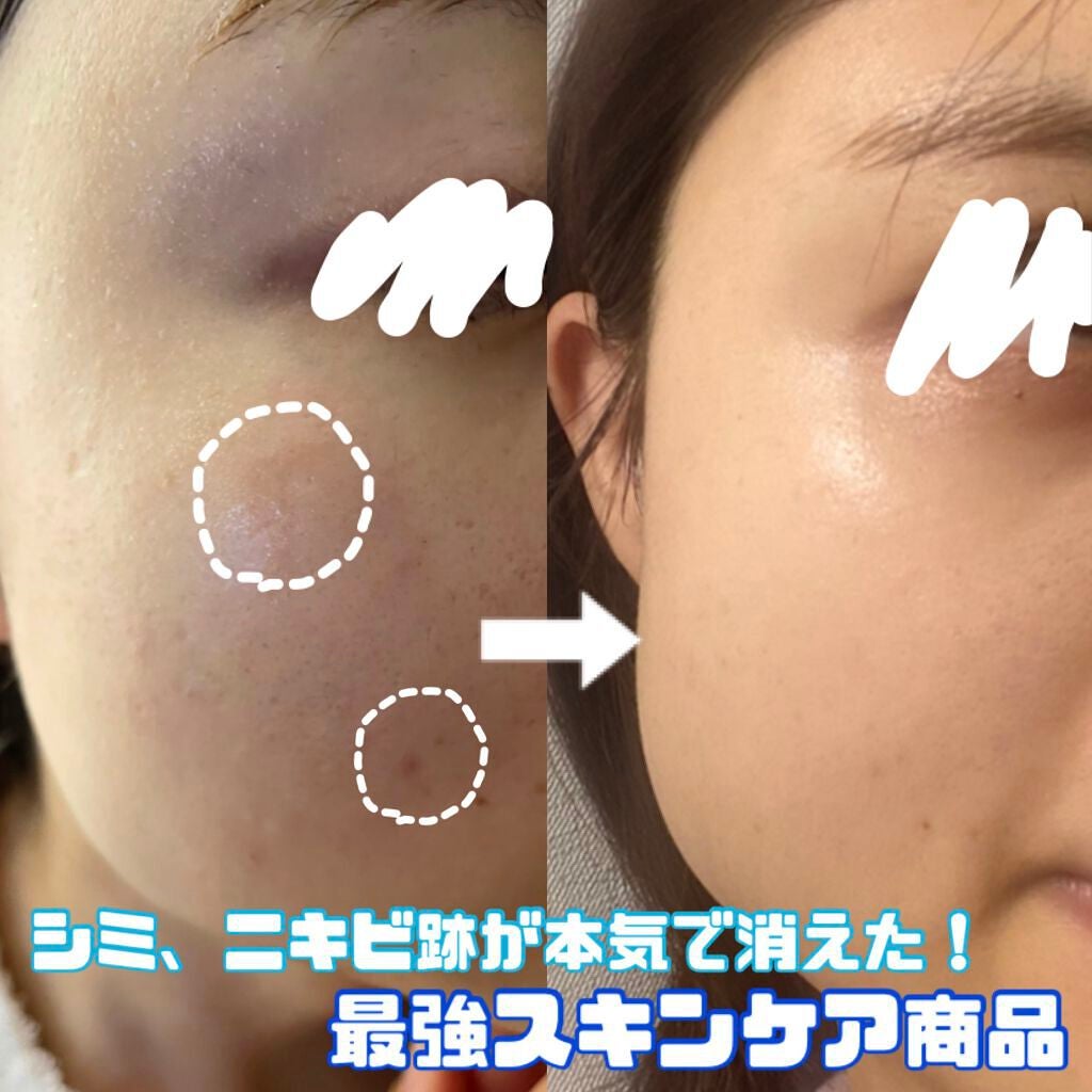 ハイドロクリームPHQ-8/KISO/美容液を使ったクチコミ(1枚目)