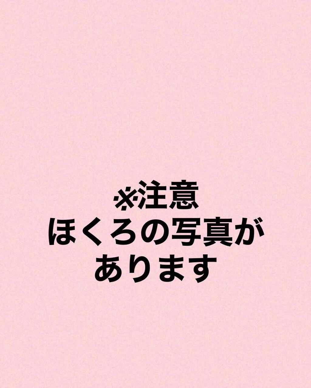 あめ on LIPS 「ほくろ除去した女子大生の経過日記はじめまして。今回美容皮膚科で..」(2枚目)