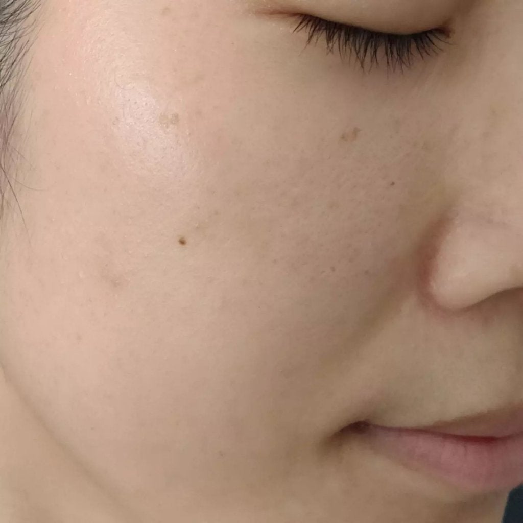 スキンコンディショナー/シェルミラック/頭皮ケアを使ったクチコミ(5枚目)