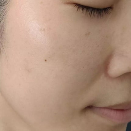 スキンコンディショナー/シェルミラック/頭皮ケアを使ったクチコミ(5枚目)