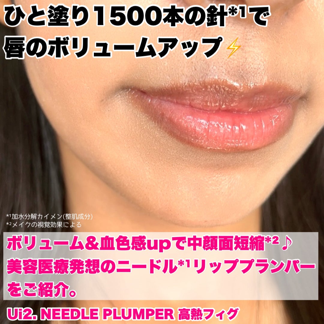 ニードルプランパー 高熱フィグ/Ui2./リッププランパーを使ったクチコミ(2枚目)