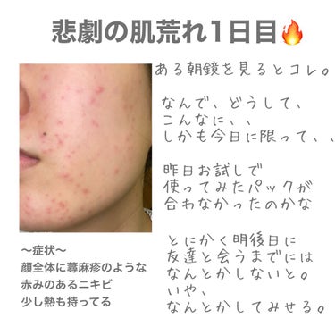 キールズ ハーバル トナー CL アルコールフリー/Kiehl's/化粧水を使ったクチコミ（1枚目）