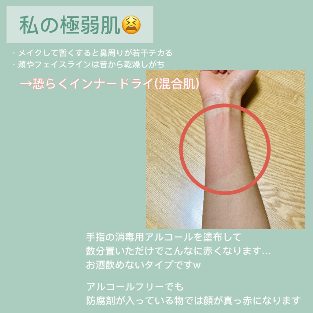 ミノン アミノモイスト 薬用アクネケア ローション/ミノン/化粧水を使ったクチコミ(3枚目)