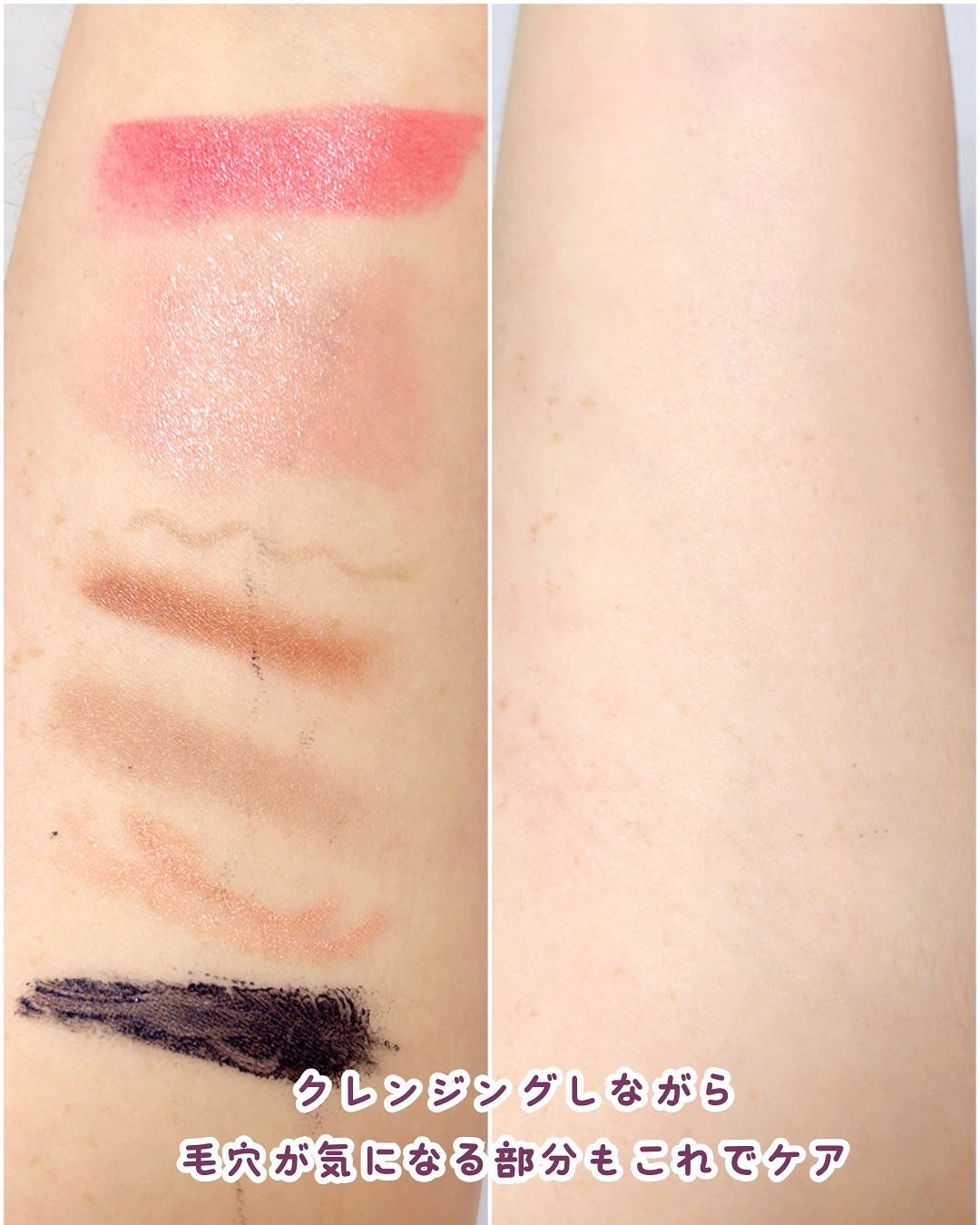 デュオ ザ クレンジングバーム ブラックリペア/DUO/クレンジングバームを使ったクチコミ(5枚目)