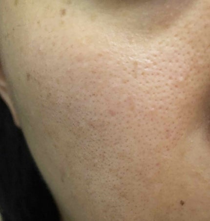 薬用しみ対策 美白化粧水/メラノCC/化粧水を使ったクチコミ(3枚目)