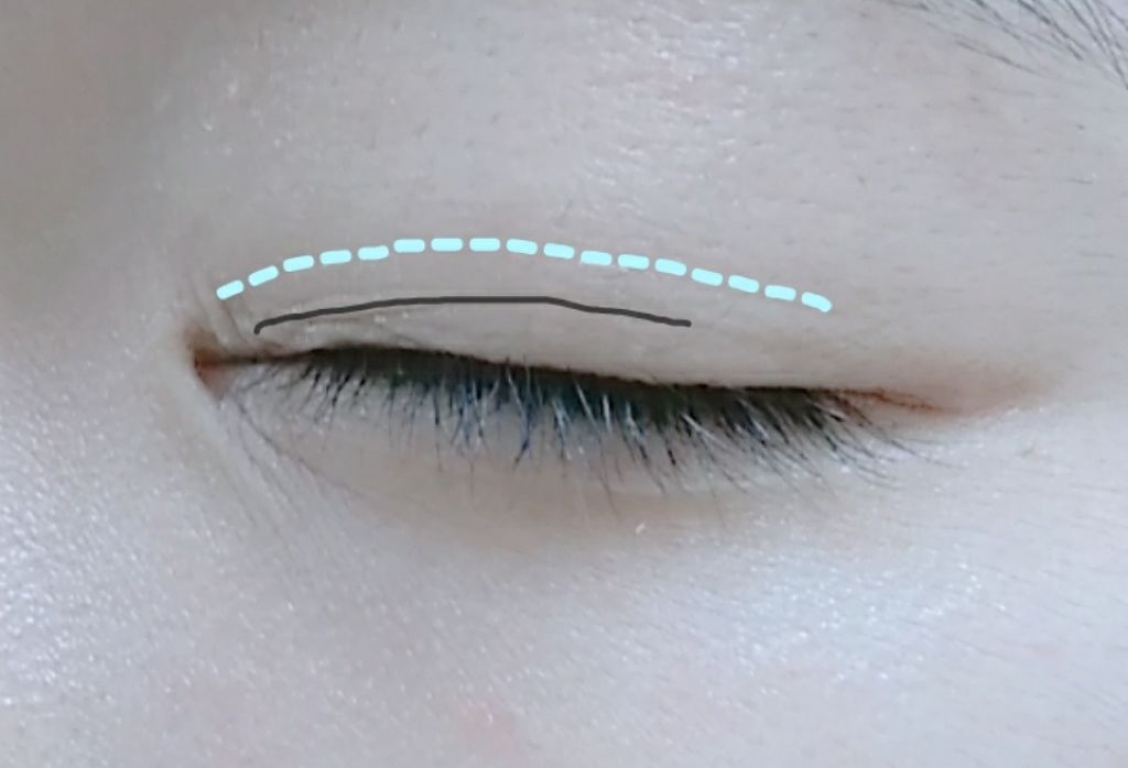 アイトーク/アイトーク/二重まぶた用アイテムを使ったクチコミ(2枚目)