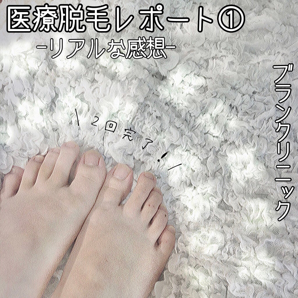 脱色クリーム 敏感肌用/エピラット/ムダ毛ケアを使ったクチコミ(1枚目)