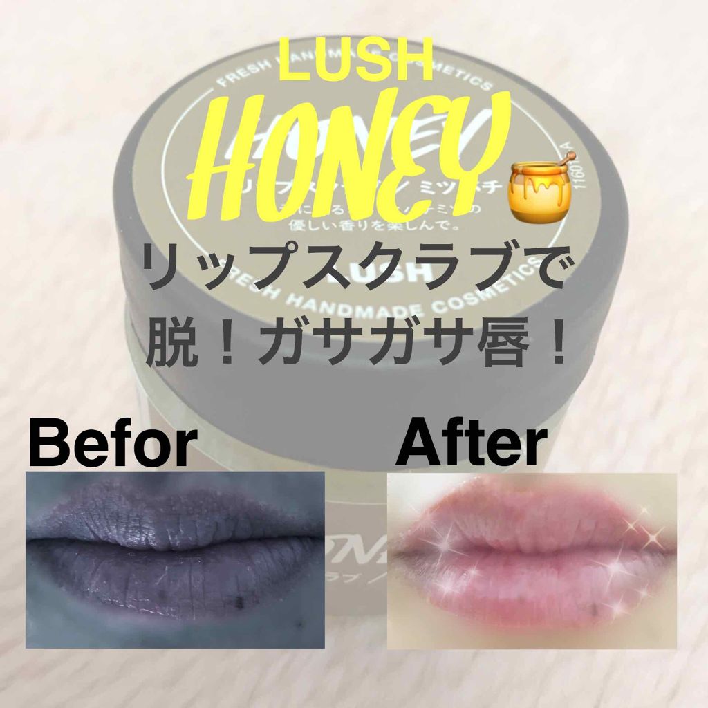 ハニーフルリップ HM/カントリー&ストリーム/リップ美容液を使ったクチコミ(1枚目)