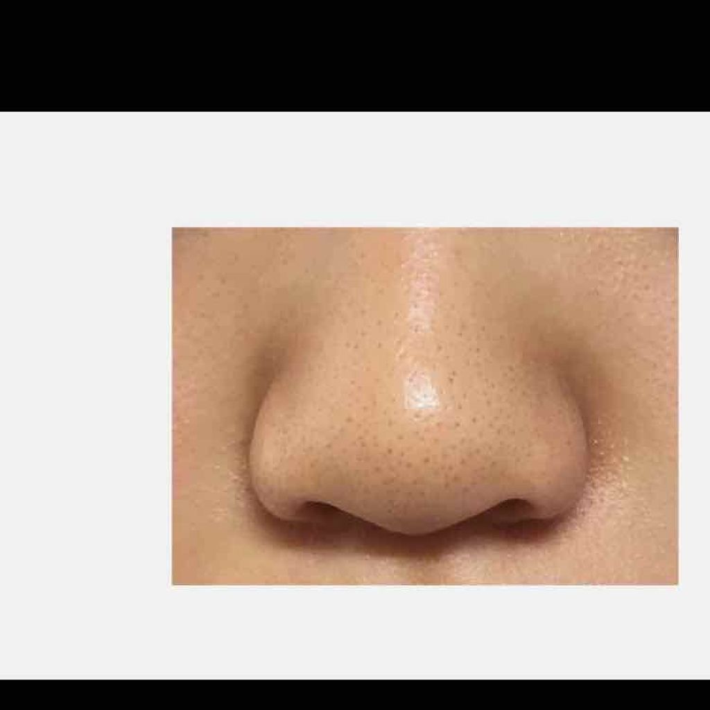 ハトムギ化粧水(ナチュリエ スキンコンディショナー R )/ナチュリエ/化粧水を使ったクチコミ(3枚目)