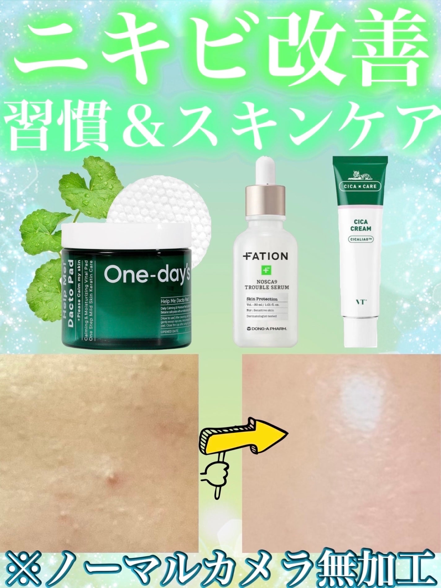 DHC 持続型ビタミンC/DHC/美容サプリメントを使ったクチコミ(1枚目)