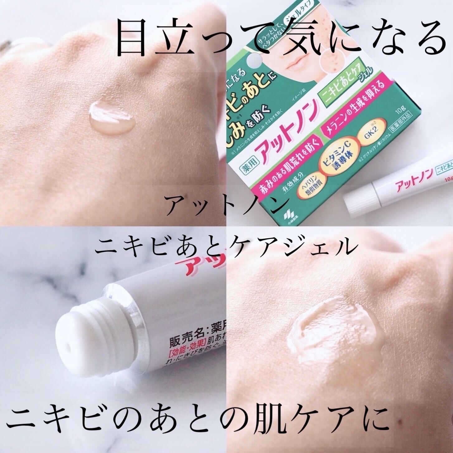 ニキビあとケアジェル/アットノン/その他スキンケアを使ったクチコミ（1枚目）