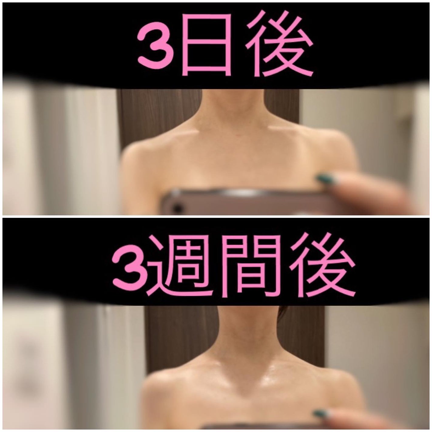 R on LIPS 「.ボトックス注射をやった結果、、、めちゃくちゃ首が長くなりまし..」(2枚目)