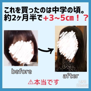 ヘアアクセルレーター レモンライムの香り/加美乃素本舗/頭皮ケアを使ったクチコミ（2枚目）