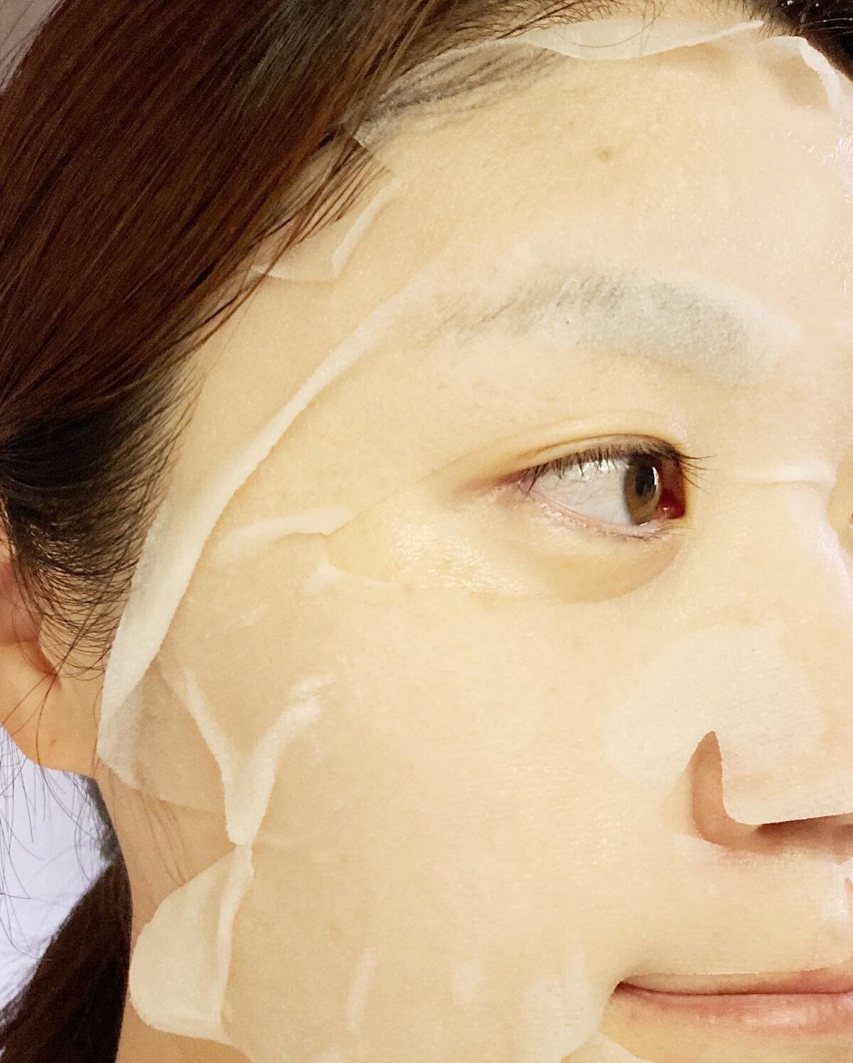 スキントラブルケア マスク/アルージェ/シートマスク・パックを使ったクチコミ（3枚目）