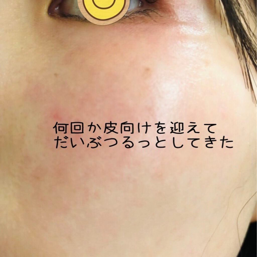 ミラミン/ZO Skin Health/フェイスクリームを使ったクチコミ(9枚目)