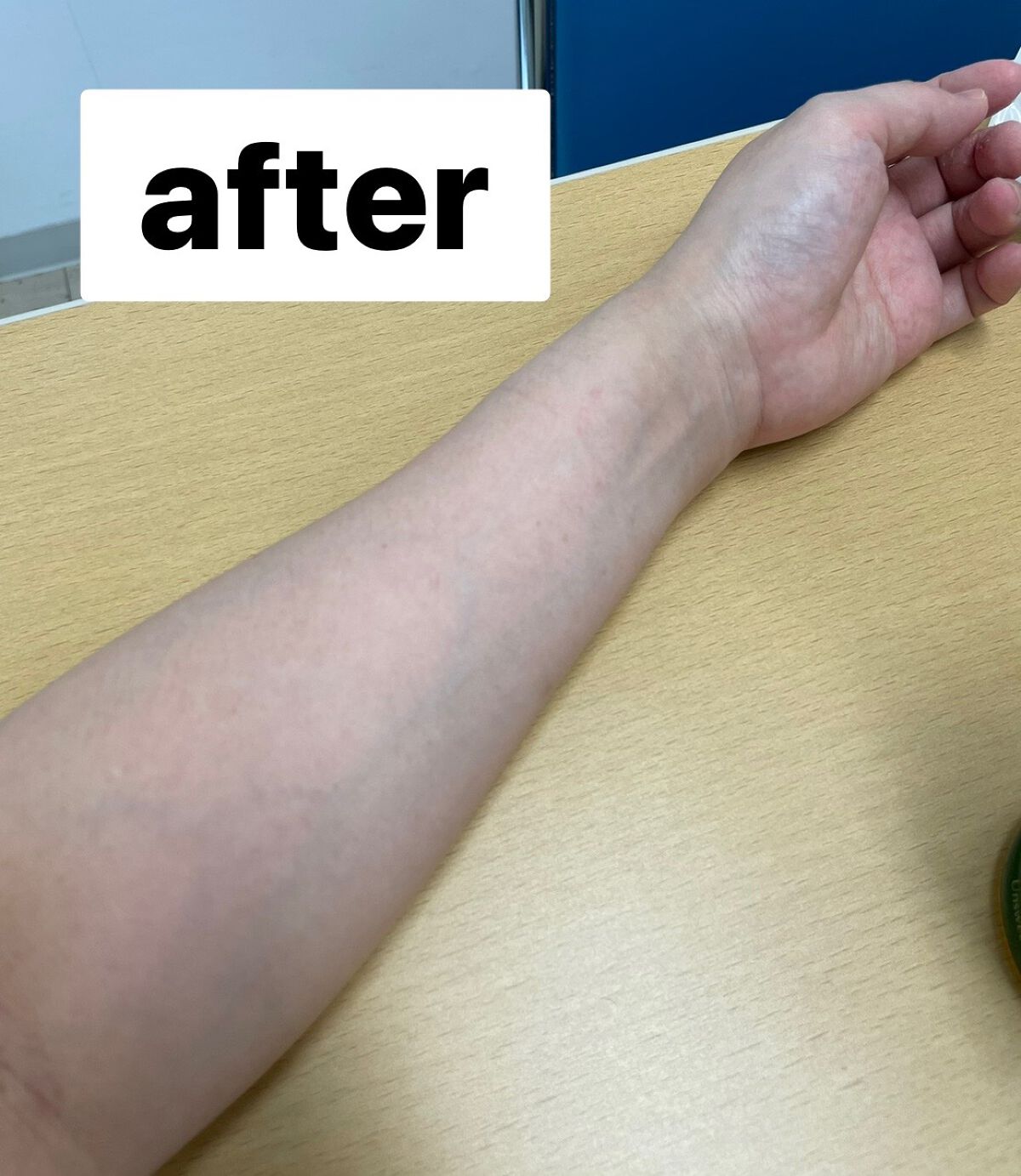 ã¿ã
ãð¥ on LIPS ãè²çœã«ãªãããæ¹å¿
èŠâ£ïžäœããããè²çœããã«ãªããã®ãðä»åã¯..ãïŒ2æç®ïŒ