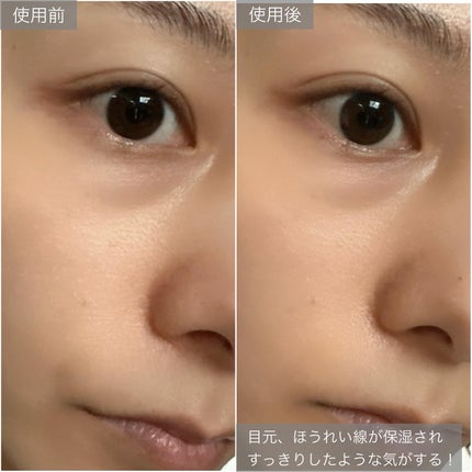 グルタチオンダークゼロトーニングパッチ/SNP/アイケア・アイクリームを使ったクチコミ(7枚目)