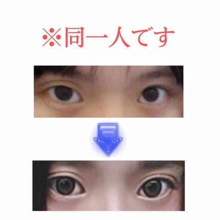 アイテープ(絆創膏タイプ、レギュラー、70枚)/DAISO/二重まぶた用アイテムを使ったクチコミ(1枚目)