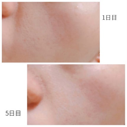 リードルS 100 2ステップマスク/VT/シートマスク・パックを使ったクチコミ(8枚目)