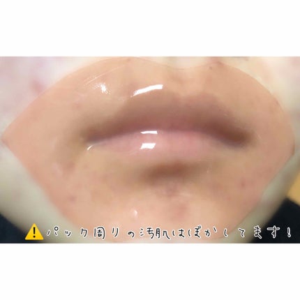 リップパック /CHOOSY/リップマスクを使ったクチコミ(3枚目)