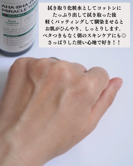 AHA·BHA·PHA 30デイズミラクルトナー/SOME BY MI/化粧水を使ったクチコミ(4枚目)