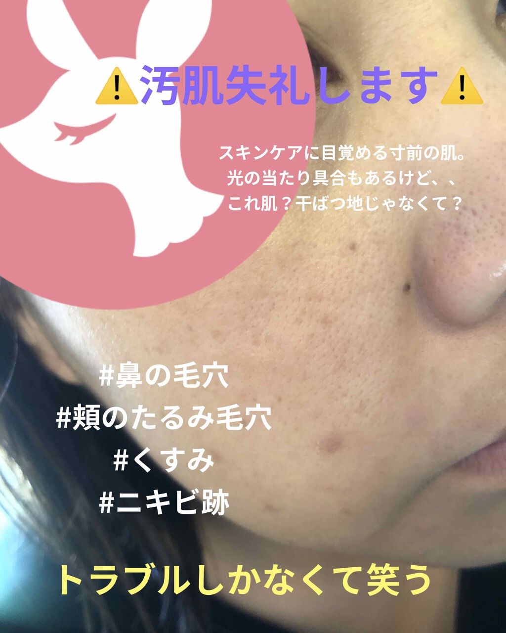 アクティブベース クリアウォッシュ/オバジ/洗顔フォームを使ったクチコミ(1枚目)