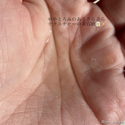 ダーマレーザー ウルセラC/クオリティファースト/美容液を使ったクチコミ(5枚目)