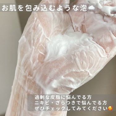 AC ピーリングソープ/NIKI PITA/洗顔石鹸を使ったクチコミ（5枚目）