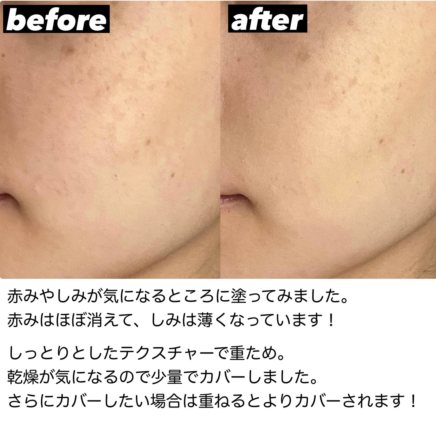 セカンドスキンカバーコンシーラー/hince/リキッドコンシーラーを使ったクチコミ(3枚目)