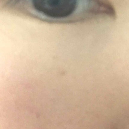 フローレス フュージョン ウルトラ ロングウェア コンシーラー/ローラ メルシエ/リキッドコンシーラーを使ったクチコミ(3枚目)