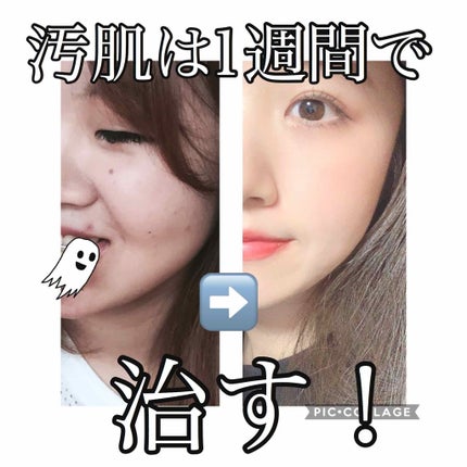 洗顔フォーム しっとりタイプ/ちふれ/洗顔フォームを使ったクチコミ(1枚目)