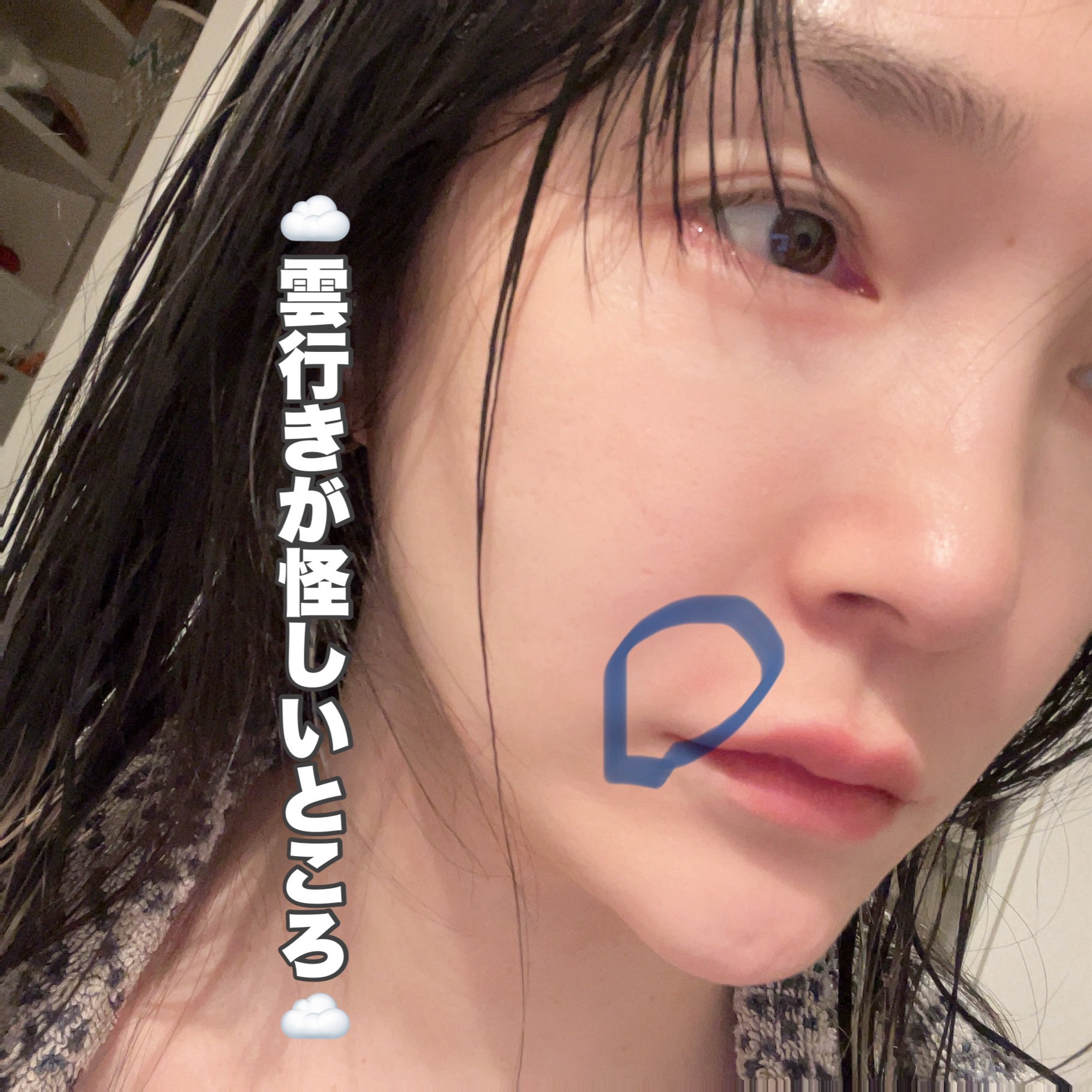 ゼロ1DAYエクソソームショット7500/MEDICUBE/美容液を使ったクチコミ（3枚目）