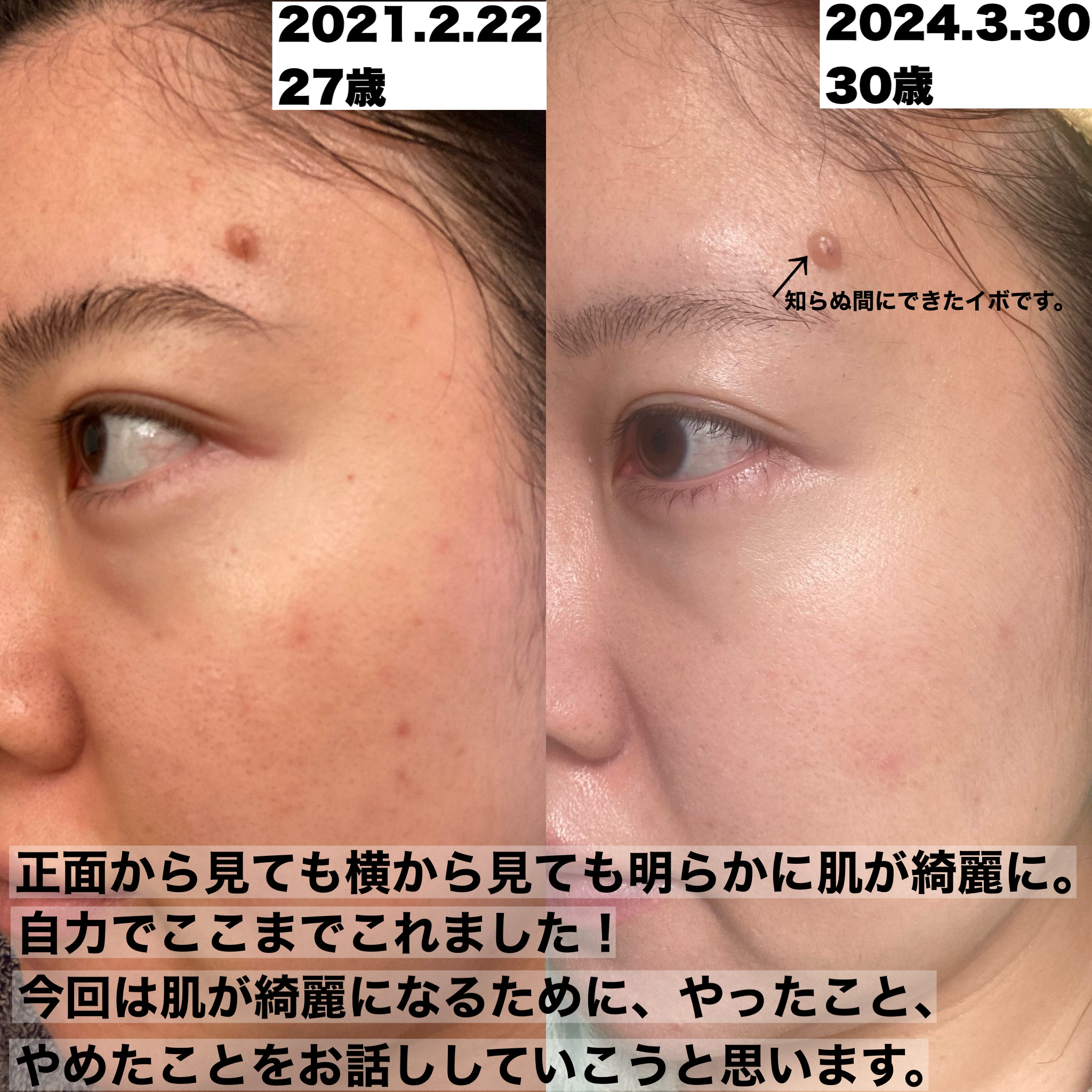 トリートメント クレンジング ミルク/COVERMARK/ミルククレンジングを使ったクチコミ（2枚目）