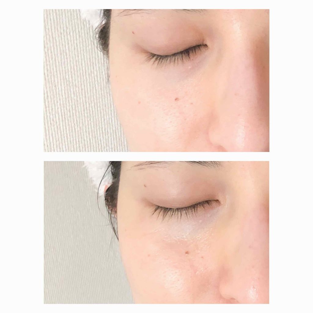 モッチスキン 吸着スクラブ/MoccHi SKIN/スクラブ・ゴマージュを使ったクチコミ(4枚目)