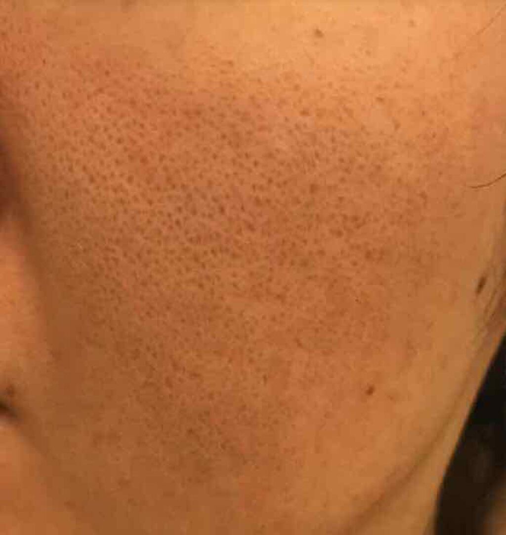 おうちdeエステ 肌をなめらかにする マッサージ洗顔ジェル/ビオレ/その他洗顔料を使ったクチコミ(4枚目)