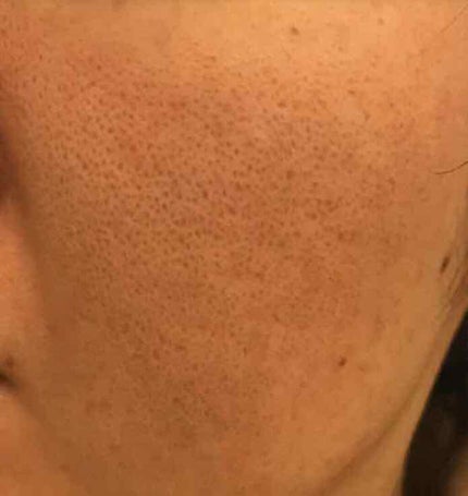 おうちdeエステ 肌をなめらかにする マッサージ洗顔ジェル/ビオレ/その他洗顔料を使ったクチコミ(4枚目)