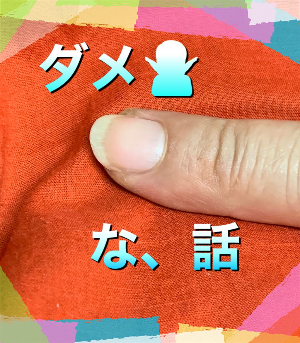 レニューフレッシュ/ボシュロム/その他を使ったクチコミ（2枚目）