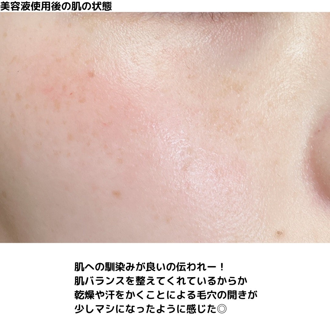 ピンクティーツリーシナジーセラム/APLIN/美容液を使ったクチコミ(8枚目)