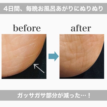 ネイチャーコンク薬用フットケアローション/ネイチャーコンク/レッグ・フットケアを使ったクチコミ(4枚目)