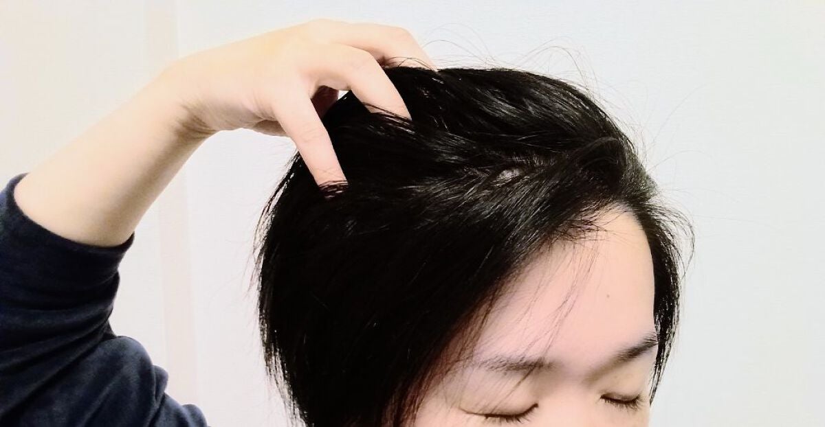 薬用スカルプセラム/wicot/頭皮ローションを使ったクチコミ(5枚目)