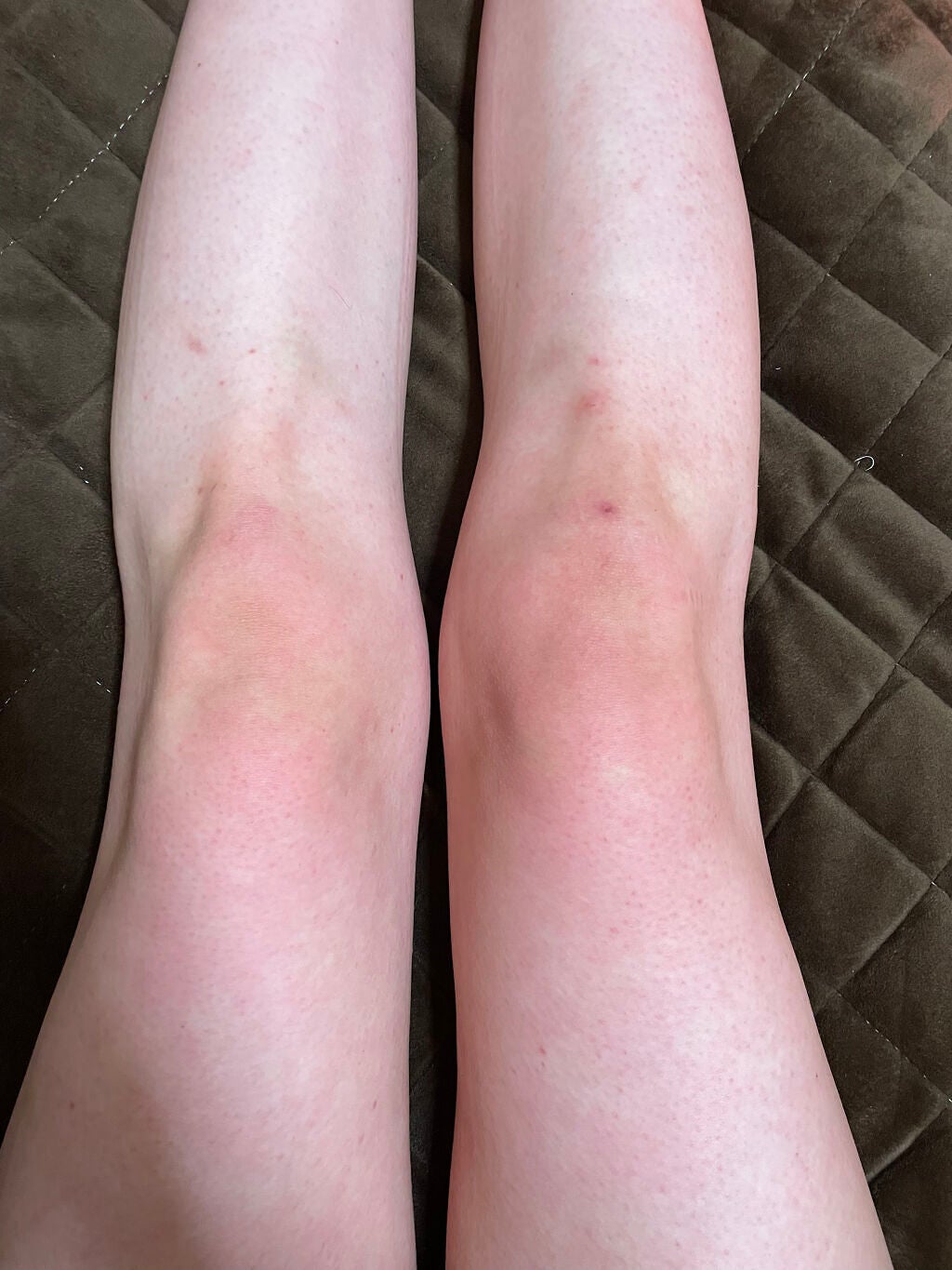 たこまる on LIPS 「経過報告!2枚目3枚目が使う前4枚目5枚目が今日です。使う前の..」(5枚目)