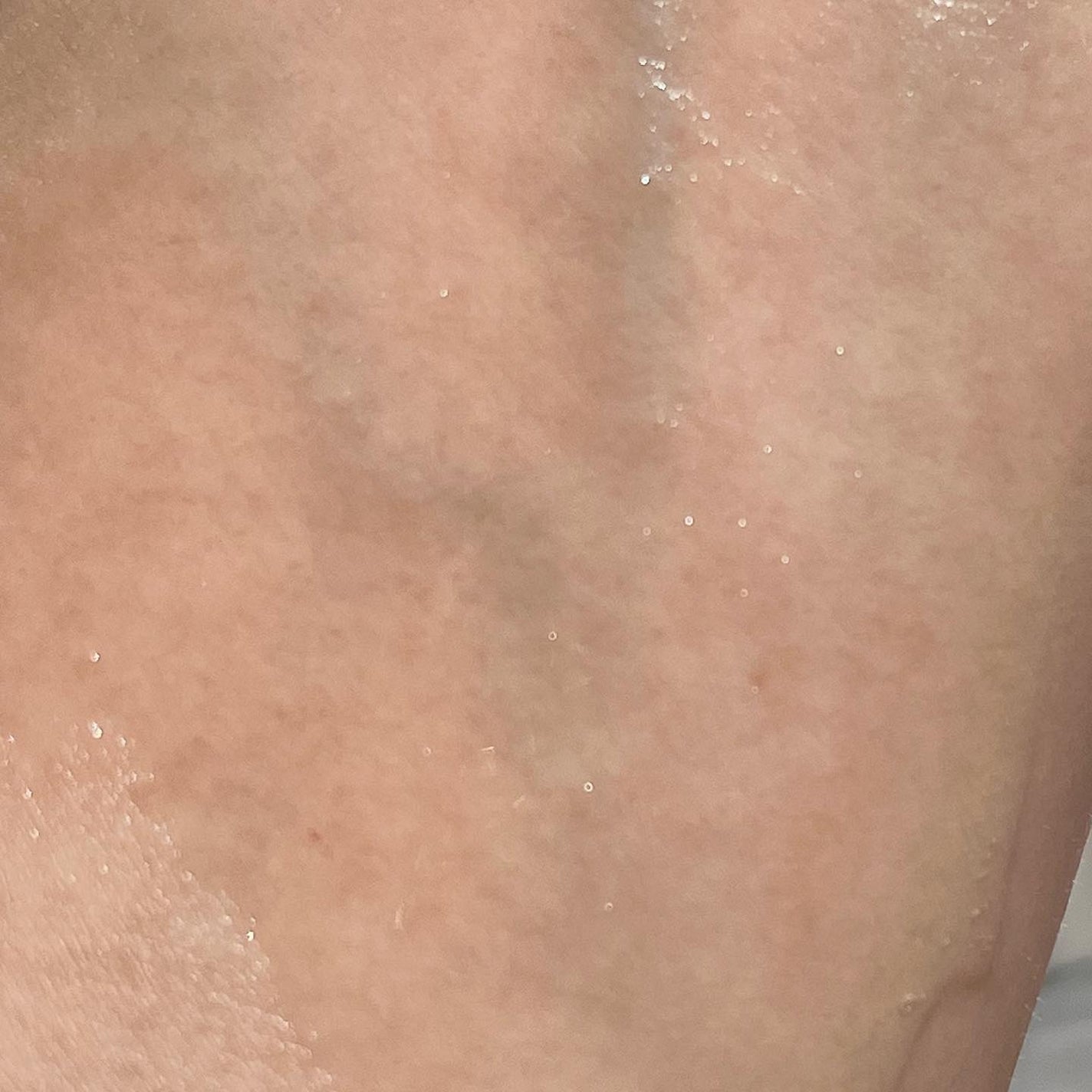 SYNERGY REPAIR AMPOULE/ASKIN/美容液を使ったクチコミ(4枚目)