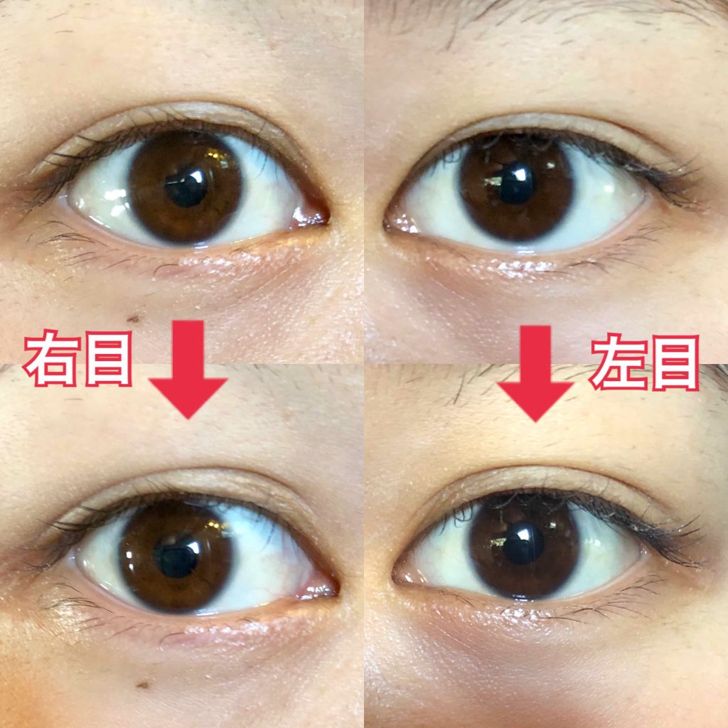 のびーるアイテープ(絆創膏タイプ、レギュラー)/DAISO/二重まぶた用アイテムを使ったクチコミ(4枚目)